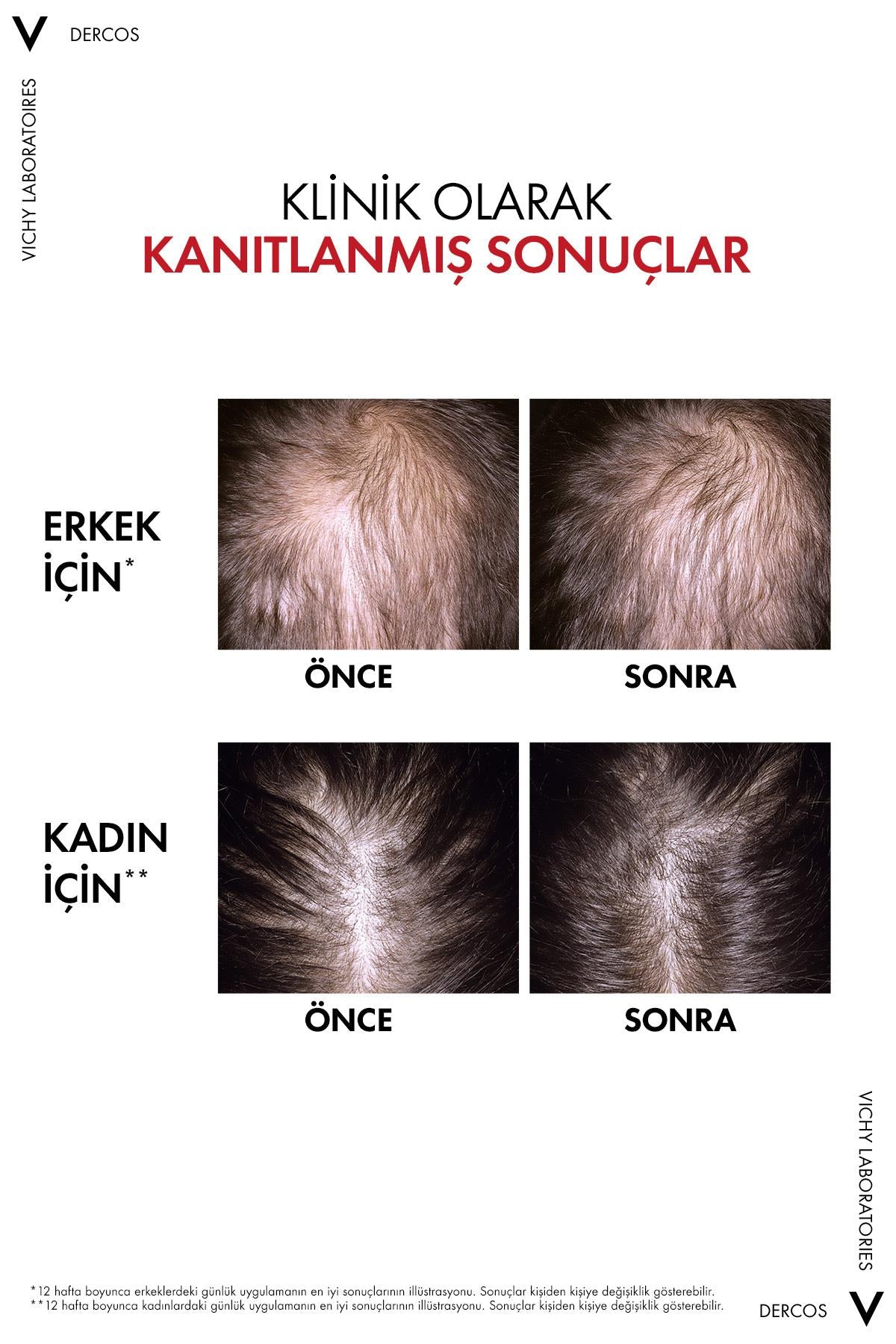 Vichy Aminexil R.E.G.E.N Booster Saç Dökülmesine Karşı Serum 90 ml