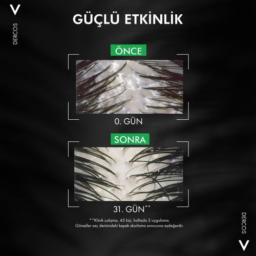 Vichy Dercos Anti Dandruff Kepek Karşıtı Şampuan 390 ml - Normal ve Yağlı Saçlar